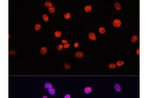 Immunofluorescence analysis of HeLa cells using MYCT1 Polyclonal Antibody at dilution of 1:100. (Myc Target 1 anticorps)
