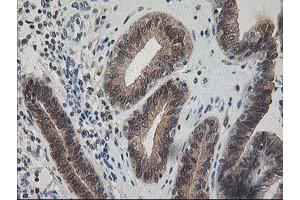 Image no. 1 for anti-Pyridoxal Kinase (PDXK) antibody (ABIN1500145)