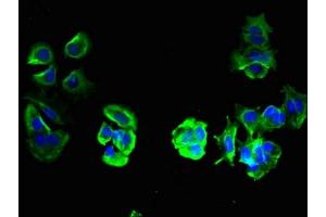 Immunofluorescent analysis of MCF-7 cells using ABIN7173139 at dilution of 1:100 and Alexa Fluor 488-congugated AffiniPure Goat Anti-Rabbit IgG(H+L) (TMEM209 anticorps  (AA 251-519))