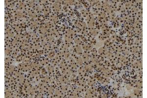 ABIN6273017 at 1/100 staining Mouse kidney tissue by IHC-P. (SYNPO2 anticorps  (Internal Region))