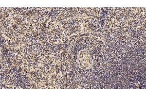 Detection of CD3e in Human Spleen Tissue using Monoclonal Antibody to T-Cell Surface Glycoprotein CD3 Epsilon (CD3e)