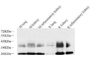 Western Blot analysis of various samples using AQP1 Polyclonal Antibody at dilution of 1:2000. (Aquaporin 1 anticorps)