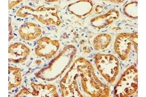 Immunohistochemistry of paraffin-embedded human kidney tissue using ABIN7143588 at dilution of 1:100 (AKR7A3 anticorps  (AA 1-331))