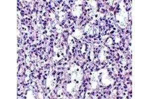 Immunohistochemistry (IHC) image for anti-TBC1 Domain Family, Member 10C (TBC1D10C) (N-Term) antibody (ABIN1031291)