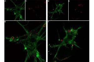 Live cell imaging of ω-Conotoxin MVIIC-Biotin in differentiated  cells.