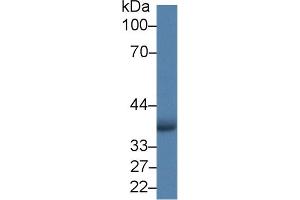 Detection of AIM2 in Human A549 cell lysate using Polyclonal Antibody to Absent In Melanoma 2 (AIM2) (AIM2 anticorps  (AA 1-343))
