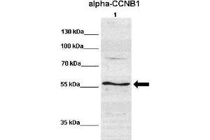 WB Suggested Anti-CCNB1 Antibody  Positive Control: Lane 1:641 µg human NT2 cell line Primary Antibody Dilution: 1:000Secondary Antibody: IRDye 800 CW goat anti-rabbit from Li-COR BioscienceSecondry  Antibody Dilution: 1:00,000Submitted by: Dr. (Cyclin B1 anticorps  (C-Term))