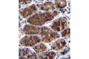 CTGF Antibody (Center) (ABIN392205 and ABIN2841905) immunohistochemistry analysis in formalin fixed and paraffin embedded human stomach tissue followed by peroxidase conjugation of the secondary antibody and DAB staining. (CTGF anticorps  (AA 134-159))