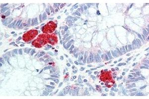 Detection of HEXb in Human Colon Tissue using Polyclonal Antibody to Hexosaminidase B Beta (HEXb) (HEXB anticorps  (AA 294-435))