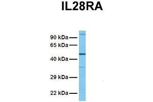 Host:  Rabbit  Target Name:  IL28RA  Sample Tissue:  Human Fetal Lung  Antibody Dilution:  1.