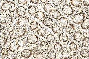 Immunohistochemical analysis of paraffin-embedded Human Colorectal section using Pink1 am2261b.