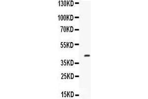 Western blot analysis of Factor D expression in mouse spleen extract (lane 1). (Adipsin anticorps  (AA 30-235))