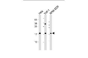 All lanes : Anti-GPX7 Antibody (Center) at 1:2000 dilution Lane 1: Hela whole cell lysate Lane 2: THP-1 whole cell lysate Lane 3: RI 8226 whole cell lysate Lysates/proteins at 20 μg per lane. (Glutathione Peroxidase 7 anticorps  (AA 73-107))