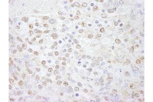 Immunohistochemistry (IHC) image for anti-Polymerase (DNA Directed), lambda (POLL) (AA 525-575) antibody (ABIN7448731) (POLL anticorps  (AA 525-575))