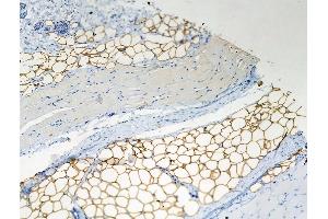 Phospho-Perilipin-1 (Ser522) Antibody at 1/100 staining Rat skin tissue by IHC-P. (PLIN1 anticorps  (pSer522))
