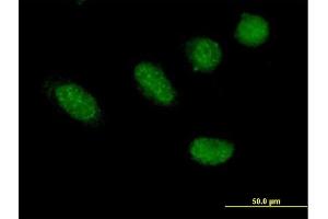 Immunofluorescence of purified MaxPab antibody to GRHL2 on HeLa cell. (GRHL2 anticorps  (AA 1-625))