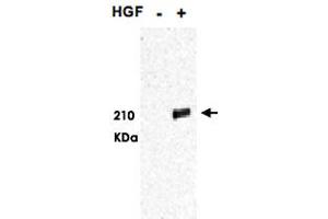 Western blot using MET (phospho Y1349/1356) polyclonal antibody  shows detection of phosphorylated MET. (c-MET anticorps  (pTyr1349, pTyr1356))