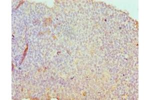 Immunohistochemistry of paraffin-embedded human tonsil tissue using ABIN7171193 at dilution of 1:100 (Syndecan 1 anticorps  (AA 25-240))