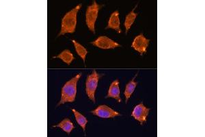 Immunofluorescence analysis of L929 cells using  antibody (ABIN7265407) at dilution of 1:100. (ATF5 anticorps)