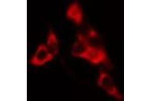 ABIN6275216 staining HuvEc cells by IF/ICC. (LSP1 anticorps  (C-Term))