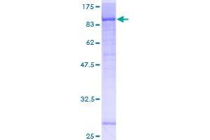Image no. 1 for Katanin P80 (WD Repeat Containing) Subunit B 1 (KATNB1) (AA 1-655) protein (GST tag) (ABIN1308368)