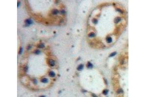 IHC-P analysis of Kidney tissue, with DAB staining. (Claudin 1 anticorps  (AA 50-197))