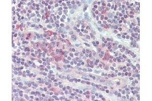 Human Small Intestine, MALT: Formalin-Fixed, Paraffin-Embedded (FFPE)