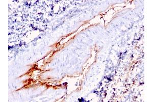 Formalin-fixed, paraffin-embedded human Spleen stained with vWF Mouse Monoclonal Antibody (VWF/1767). (VWF anticorps  (AA 1815-1939))