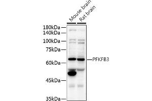Western blot analysis of extracts of various cell lines, using PFKFB3 antibody (ABIN6129841, ABIN6145485, ABIN6145487 and ABIN6222692) at 1:500 dilution.