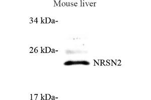 Western blot analysis of NRSN2 (ABIN7074806) at dilution of 1: 500 (NRSN2 anticorps)