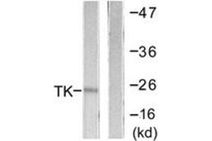 Western Blotting (WB) image for anti-Thymidine Kinase 1, Soluble (TK1) (AA 1-50) antibody (ABIN2888706) (TK1 anticorps  (AA 1-50))