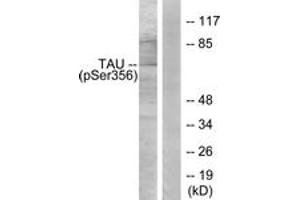 Western blot analysis of extracts from 293 cells treated with serum 10% 15', using Tau (Phospho-Ser356) Antibody. (tau anticorps  (pSer673))