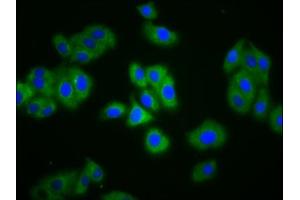 Immunofluorescence staining of HepG2 cells with ABIN7151491 at 1:133, counter-stained with DAPI. (NBC4 anticorps  (AA 1071-1137))