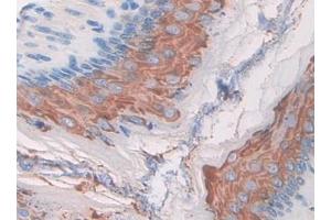 DAB staining on IHC-P; Samples: Mouse Stomach Tissue (MST1R anticorps  (AA 89-275))