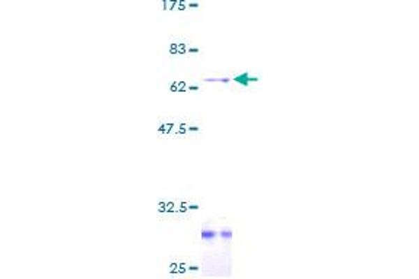 LDLRAP1 Protein (AA 1-263) (GST tag)