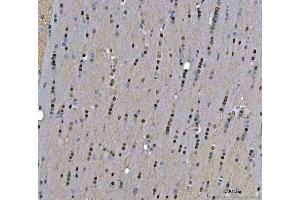 IHC analysis of TIGD1 using anti-TIGD1 antibody (ABIN7602407).