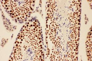 Anti-BRCA1 Picoband antibody,  IHC(P): Mouse Testis Tissue