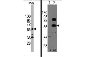 Image no. 1 for anti-SRY (Sex Determining Region Y)-Box 9 (SOX9) (N-Term) antibody (ABIN356879) (SOX9 anticorps  (N-Term))