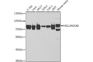 Western blot analysis of extracts of various cell lines, using HEC1/HEC1/NDC80 antibody (ABIN6131748, ABIN6144439, ABIN6144441 and ABIN6221060) at 1:1000 dilution. (NDC80 anticorps  (AA 343-642))