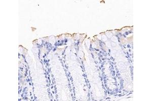 Immunohistochemistry analysis of paraffin-embedded mouse colon using,PLS1 (ABIN7075096) at dilution of 1: 2000