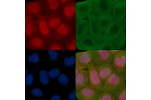 ABIN7095311 and ABIN7099368 staining Hela cells(30 min of UV treatment) by IF/ICC. (SOHLH2 anticorps)