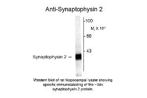 Western blot of Anti-Synaptophysin 2 (Rabbit) Antibody - 612-401-E36 Western Blot of Rabbit anti-Synaptophysin 2 antibody. (Synaptophysin 2 anticorps  (C-Term))
