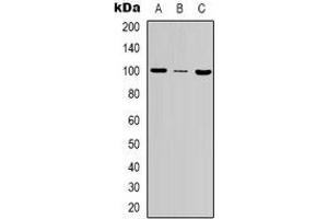 Western blot analysis of MSH2 expression in Hela (A), A431 (B), NIH3T3 (C) whole cell lysates.