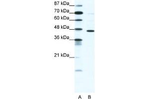 WB Suggested Anti-GABRP Antibody   Titration: 1. (GABRP anticorps  (N-Term))