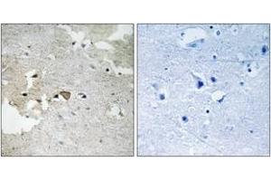 Immunohistochemistry analysis of paraffin-embedded human brain, using AXL (Phospho-Tyr691) Antibody. (AXL anticorps  (pTyr691))