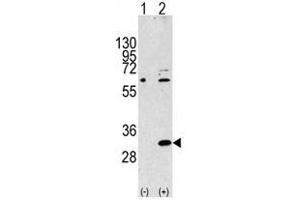 Image no. 2 for anti-Eukaryotic Translation Initiation Factor 4E Family Member 2 (EIF4E2) (N-Term) antibody (ABIN357298) (EIF4E2 anticorps  (N-Term))