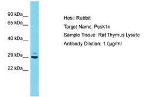 Image no. 1 for anti-Proprotein Convertase Subtilisin/kexin Type 1 Inhibitor (PCSK1N) (AA 54-103) antibody (ABIN6750411) (PCSK1N anticorps  (AA 54-103))