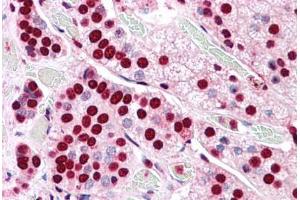 Human Adrenal: Formalin-Fixed, Paraffin-Embedded (FFPE)