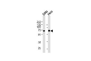 NLK Antibody (ABIN1882269 and ABIN2843492) western blot analysis in SiHa,Hela cell line lysates (35 μg/lane). (Nemo-Like Kinase anticorps)
