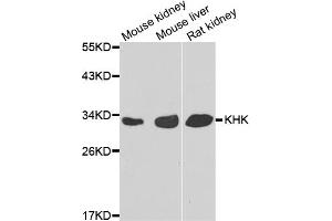 Western blot analysis of extracts of various cell lines, using KHK antibody (ABIN5975535) at 1/1000 dilution. (Ketohexokinase anticorps)